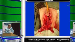 Окулов А Б - Значение пластики входа во влагалище при этапном хирургическом лечении