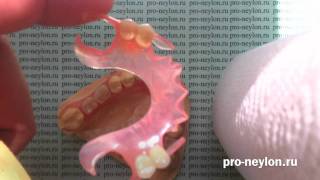 Нейлоновые протезы -  Nylon prosthesis