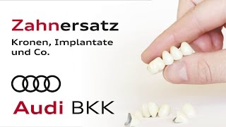Zahnersatz - Kronen, Implantate und Co