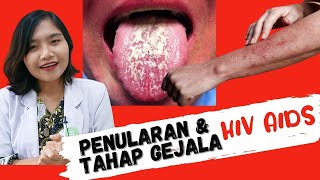 #HIVAIDS 1 | Penularan dan Tahap Gejala HIV AIDS | dr. Ema Surya P