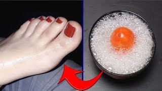Foot Whitening Bleach | বছরের পর বছর জমে থাকা ময়লা পা হয়ে উঠবে দুর্দান্ত ফর্সা | Foot Whitening