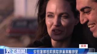 0324 娛樂，安祖蓮娜祖莉摘取卵巢與輸卵管