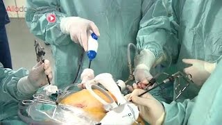 Opérer le cancer du pancréas - Allô Docteurs