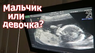 VLOG: Решилась на УЗИ /  Письмо деду морозу