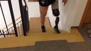 Otto Bock Genium Knee , AK amputee walking upstairs