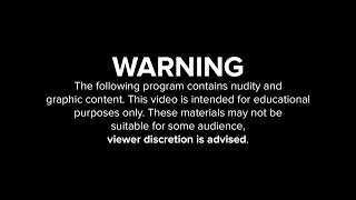 Internal BRA Lift & Reduction - Warning Contains Nudity