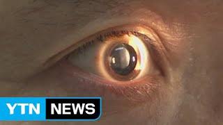 시력장애 일으키는 황반변성, 원인과 예방법은? / YTN
