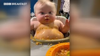 Baby Albie, who has Down syndrome, went viral after rubbing his spaghetti dinner all over his tummy