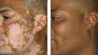 JEUNESSE SERUM/RESERVE Before and After