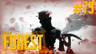 Bezbronny Xalion - The Forest #79