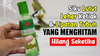 Z3LANG.KANGAN MENGHITAM, SIKU & KETEK GELAP, OLESKAN SAJA INI, LANGSUNG PUTIH KINCLONG | SEHAT TUBE