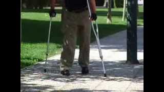 Leg braces Pedro