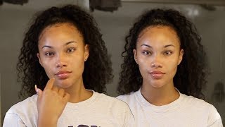 SUPA CLEAR SKIN | MY SKINCARE ROUTINE