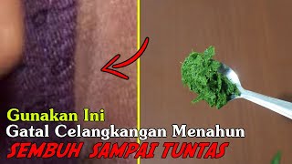 PATEN SEJAK NENEK MOYANG, GATAL-GATAL MENAHUN SEMBUH SAMPAI KE AKAR-AKARNYA 