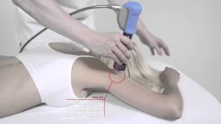 Evo Blue treatment - Primary and Secondary Lymphedema