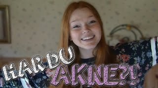 HAR DU AKNE?!