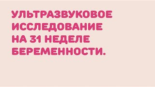 УЗИ 31 неделя беременности