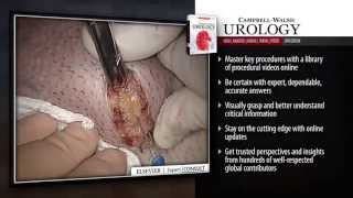 Campbell-Walsh Urology, 10th Edition