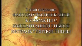 Комбинированная СТ+ФЭК (д-р Дьяконова Т.В.)