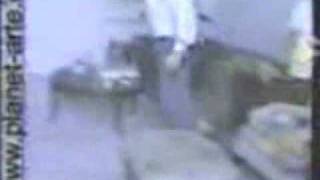 RAK right above knee male amputee with a pegleg