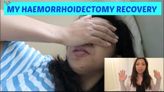 MY HAEMORRHOIDECTOMY EXPERIENCE | PART2 | RECOVERY TIME