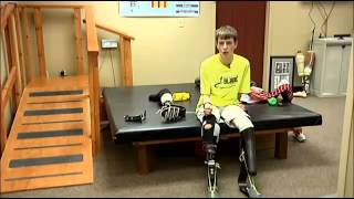 Local organization gives amputee athlete hope of computation