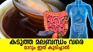 കടുത്ത മലബന്ധം വരെ മാറും ഇത് കുടിച്ചാൽ | How To Get Rid of Constipation Naturally
