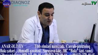 saglamTV. Anar Aliyev. Proktoloq. anar aliyev Qebizlik ve düz bağırsaq çatlarının müalicesi