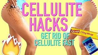 HOW TO GET RID OF CELLULITE FAST!!! | 10 HACKS THAT REALLY WORK!!!