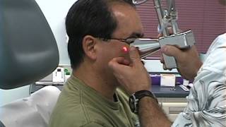 MicroLaser Peel