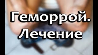 Геморрой лечение: свечи, мази и народные методы