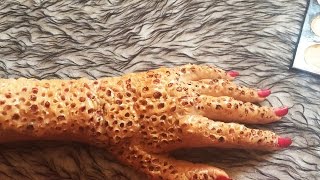 Трипофобия: этой фобией страдают 99% населения планеты