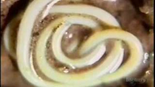 Parasites Eating Us Alive Part 1 of 6 (VIWER DISCRETION IS ADVISED)