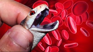 УКУСЫ ЯДОВИТЫХ ЗМЕЙ. Часть 2. Effects of venomous snake bites