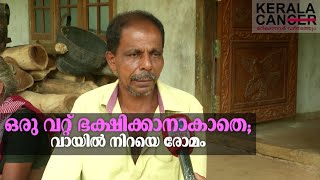 സ്റ്റീഫന്റെ വായ തുറന്നു കണ്ടാൽ ആരും നടുങ്ങും; വായ്ക്കുള്ളിൽ നിറഞ്ഞ് രോമം!