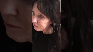 Vlog 19: Merry Christmas! Two Weeks after Amputation