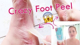 Baby Foot Mask | Ich ziehe meine FUßHAUT AB | Fußpflege- Hornhaut am Fuß entfernen | My SummerFoot