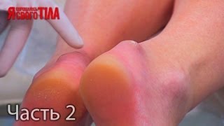 Я стесняюсь своего тела. Сезон 3. Выпуск 8. Часть 2 из 5