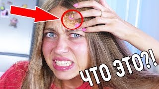 ЧУТЬ НЕ РАЗЪЕЛО КОЖУ! ТОП ЛАЙФХАКИ