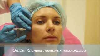 Контурная пластика, инъекции гиалуроновой кислоты