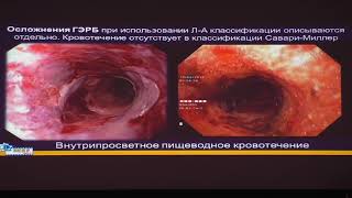 24 Федоров ЕД Эозинофильный эзофагит