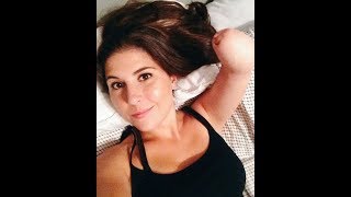 Young woman amputated leg and hand