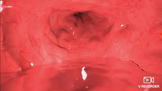 Pov: vore i ate you now your in my belly...
