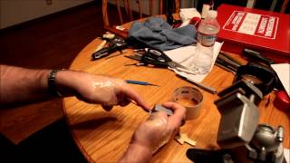 (014) Two Thumbs Gone: American Lock Series 10 -- English Patient Style