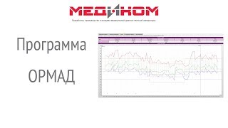 Обработка суточной записи АД в программе Ормад