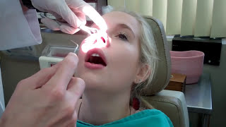 Paulina Getting Her Nose Splints Removed!