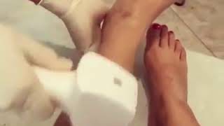 DV 4/Good feedback of our 808nm diode laser hair removal machine
