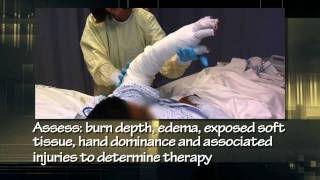 Burn Center Splints & Scar-UF Department of Surgery