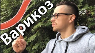 Как избавиться от Варикоза навсегда. Профилактика и лечение Варикоза.