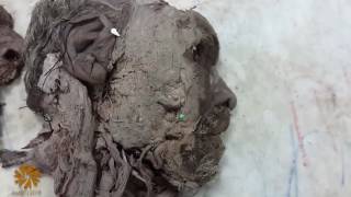 Anatomy Practical - Dr.Aly - Anatomy of The Face